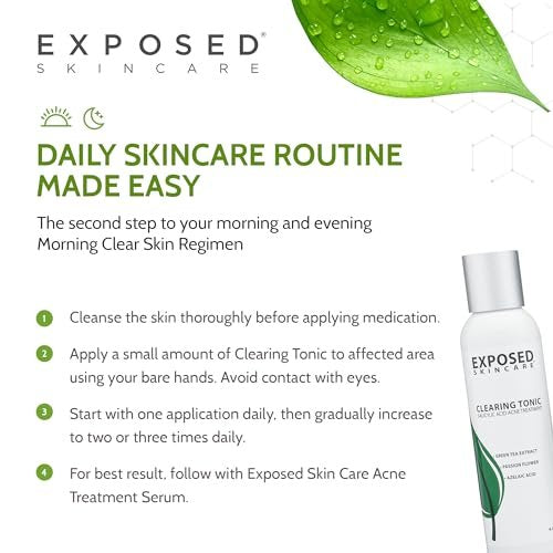 Exposed Skin Care Clearing Tonic Facial Toner – 1% Salicylic Acid & Witch Hazel for Acne, Blackheads & Oily Skin – Natural, Non-Toxic, Cruelty Free Avelisse