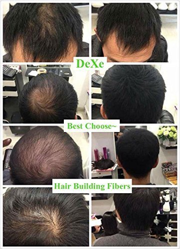 Black Hair Building Fibers – Natural Thickening Concealer for Thinning Hair, Instant Fuller Hair for Women and Men, 0.77 oz - görsel 10