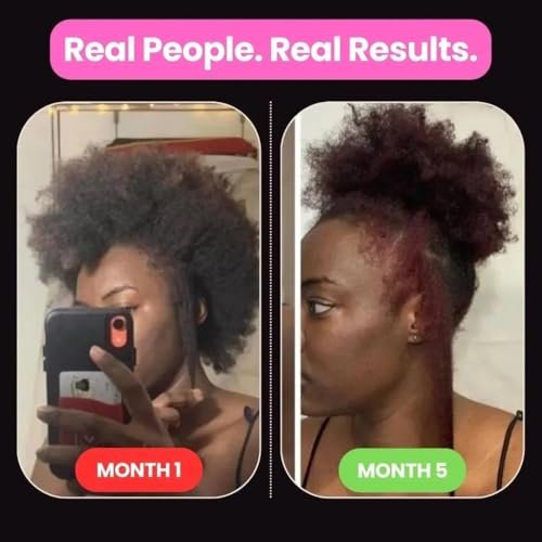 10 in 1 Hair Growth Oil with African Chebe Powder – Extreme Hair Growth Treatment, 2 Fl Oz Avelisse
