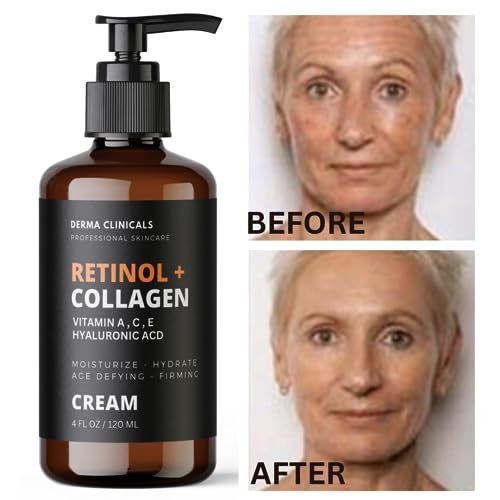 Retinol + Collagen Anti-Aging Face Cream with Hyaluronic Acid, Vitamin C - Day and Night Moisturizer for Wrinkles and Firming - 4 oz Avelisse