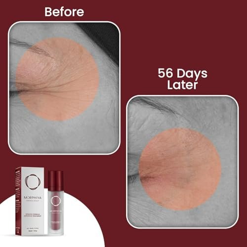 Morphiya Genesis Formula Intensive Treatment 30 ml – Advanced Face Moisturizer for Youthful Skin - görsel 12