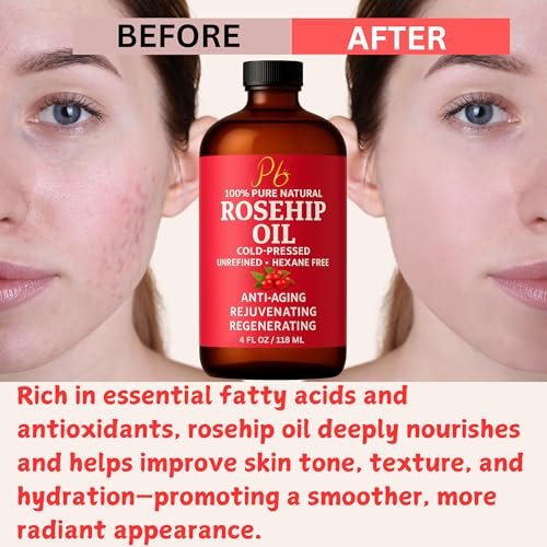 Pomberries Rosehip Seed Oil – Cold-Pressed & Unrefined, Natural Face Oil for Scars, Wrinkles, Stretch Marks & Daily Hydration, 4 fl oz - görsel 18