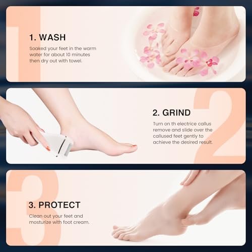 PRITECH Electric Foot Callus Remover - Rechargeable Portable Electronic Foot File Pedicure Kit with 3 Roller Heads, 3 Speeds, Battery Display for Cracked Heels & Calluses (White) Avelisse