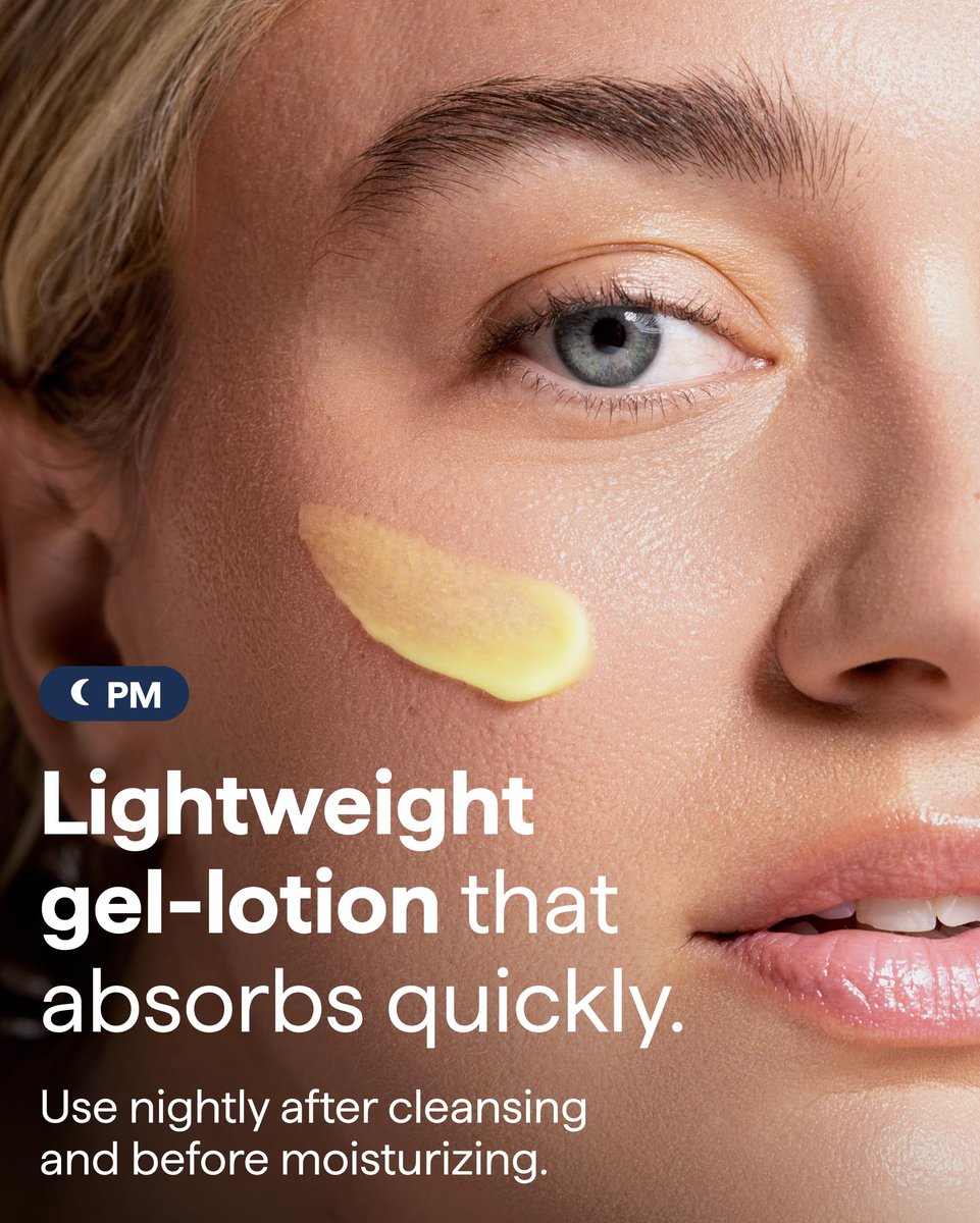 Advanced Discoloration Correcting Serum for Dark Spots | Retinol, Kojic Acid, Tranexamic Acid, Niacinamide, Mandelic Acid | Fragrance Free | Sensitive Skin | By Dermatologist Dr. Shah | 1 fl oz Avelisse