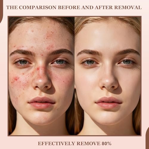 Rice Peel Shot Glow Rice Ampoule Duo – Pore Minimizing Gentle Peel & Deep Hydration with Black Rice Exfoliant for All Skin Types (6.76 Fl Oz, 2-Pack) Avelisse