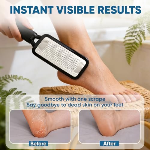 TEAWOO Foot File Callus Remover - Large Stainless Steel Foot Rasp, Heavy Duty Foot Scraper for Dead Skin & Hard Heels, Waterproof Pedicure Tool for At-Home Foot Care - görsel 12