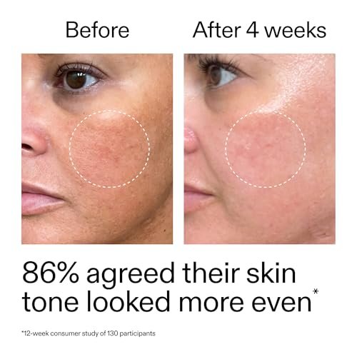 The INKEY List Starter Dual Retinol Serum - 0.5% Amisol Trio & 0.2% Symrelief, Gentle Skin Renewal, 1 Fl Oz Avelisse