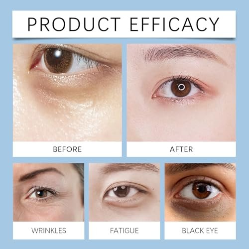 Instant Firming Eye Serum – Anti-Aging Under Eye Cream for Bags, Dark Circles, Puffiness & Wrinkles – Visibly Reduces Fine Lines & Crow's Feet with Wrinkle Filler Formula - görsel 14