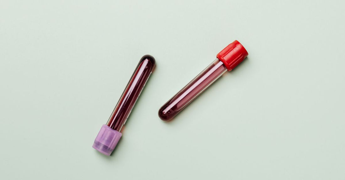 A row of shiny lip gloss tubes on a marble surface, showcasing the best lip glosses 2026 with high-shine finishes.