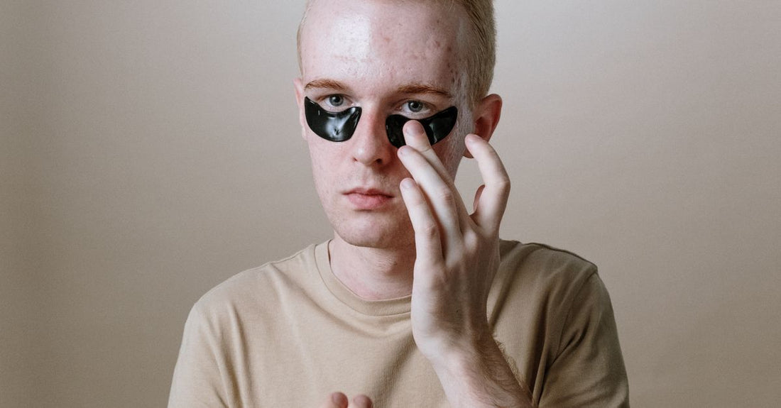 Korean hydrogel eye patches for dark circles arranged on a clean surface with skincare tools