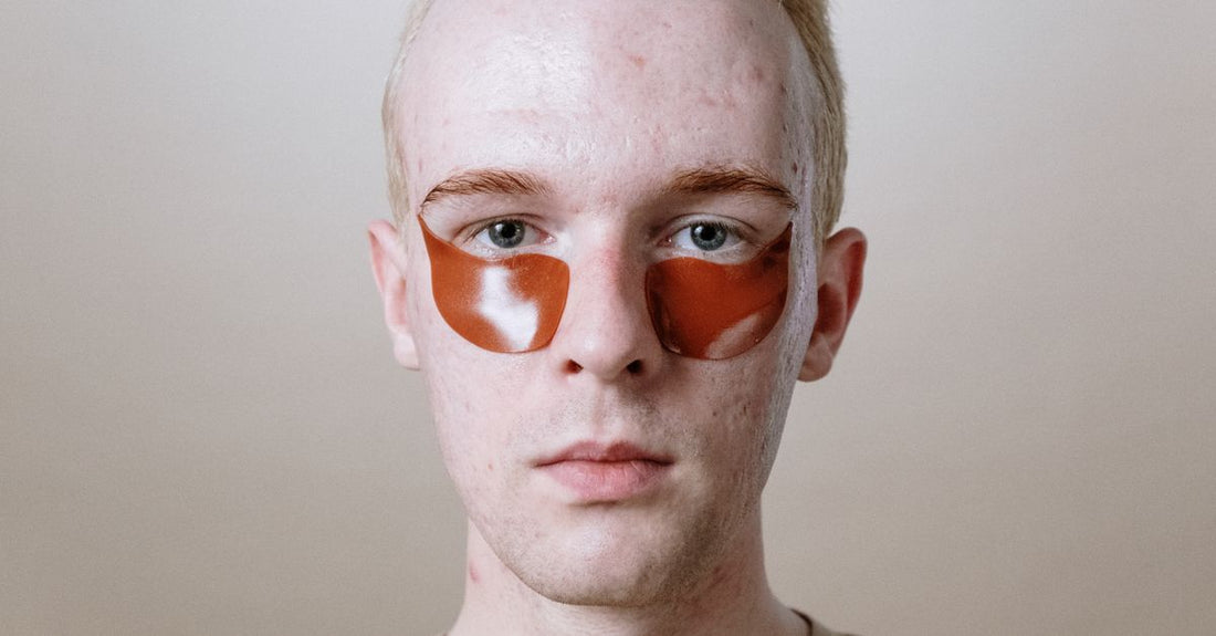 Hydrogel eye patches arranged on a cooling tray, illustrating the 2026 method for how to use eye patches for wrinkles effectively.