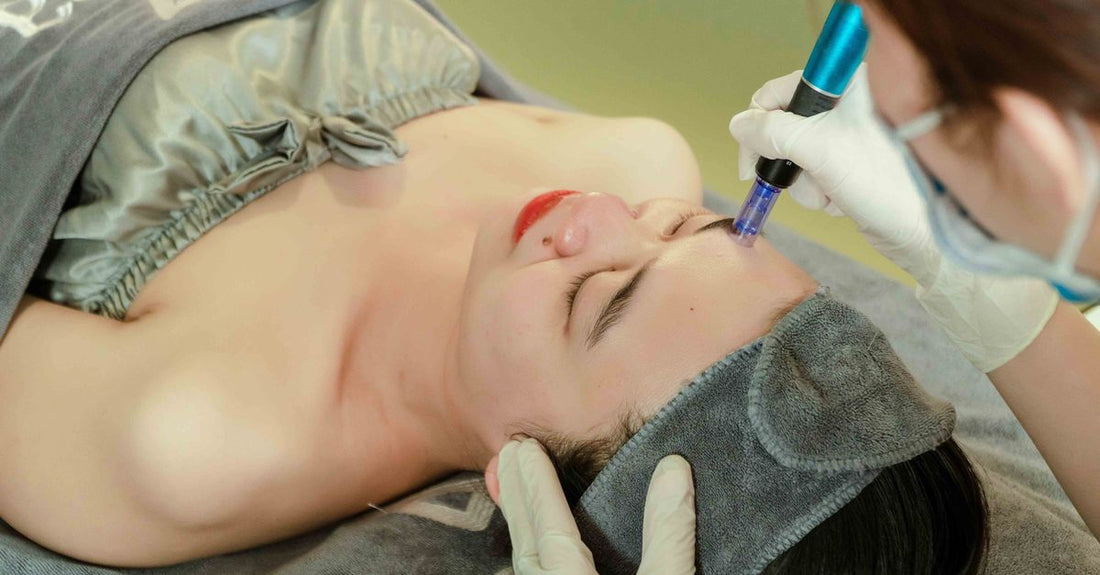 Close-up of a best microdermabrasion 2026 machine with diamond tip exfoliating wand on a clean white surface