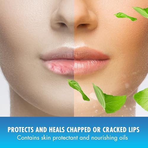 Mentholatum Natural Ice Original Medicated Lip Balm – 12-Pack, SPF 15, Moisturizing Formula for Dry, Chapped Lips - görsel 11