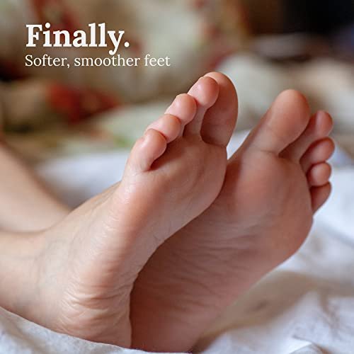 Natural Terra-Cotta Pumice Stone for Feet – Long-Lasting Callus Remover & Foot Exfoliator (Lasts 5+ Years) Avelisse