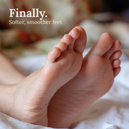 Natural Terra-Cotta Pumice Stone for Feet – Long-Lasting Callus Remover & Foot Exfoliator (Lasts 5+ Years) Avelisse
