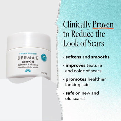 Derma E Scar Gel – Hydrating Scar Treatment for Face, Acne Scars, Burns & Stretch Marks with Panthenol & Allantoin, 2 oz