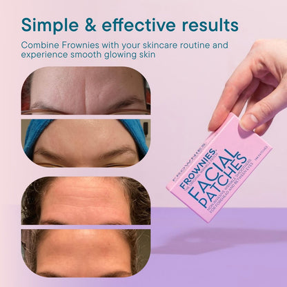 Frownies Forehead & Between Eyes Wrinkle Patches - Hypoallergenic Facial Patches for Smoothing Forehead Wrinkles & Eleven Lines - Overnight Use, 144 Count Avelisse
