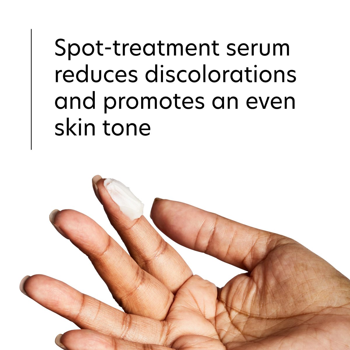 PCA SKIN Hydroquinone-Free Pigment Gel Dark Spot Corrector – Brightening Serum for Hyperpigmentation, Even Skin Tone, 1.0 oz Avelisse