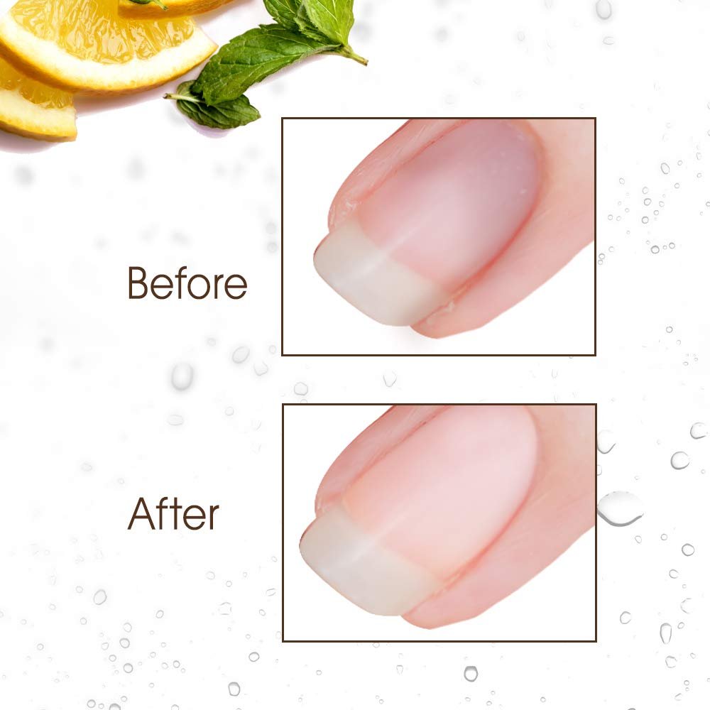 Gena Nail Brite Whitening Scrub with Brush – 4 oz Nail Cleanser & Brightener - görsel 5