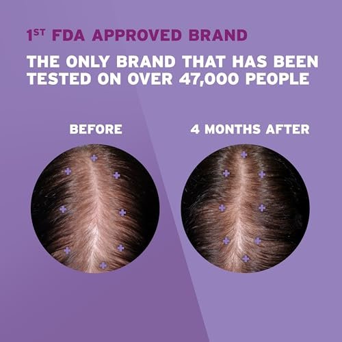 Women's Rogaine 2% Minoxidil Topical Solution for Hair Regrowth, Unscented, 2 fl. oz (1-Month Supply) Avelisse