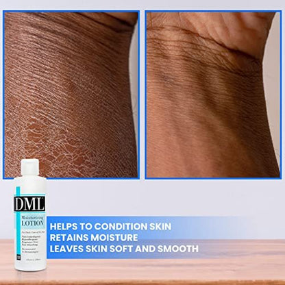 DML Fragrance Free Moisturizing Lotion – 8 oz – For Dry Skin & Eczema Relief