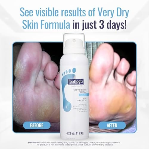 Footlogix #03 Very Dry Skin Formula – Intensive Moisturizer for Extremely Dry Feet, 4.23 oz Avelisse