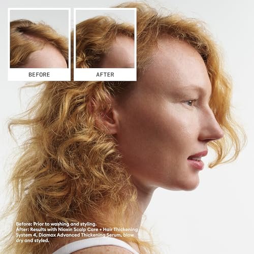Nioxin System 4 Scalp + Hair Shampoo for Colored or Damaged Hair with Progressed Thinning - 10 Fl Oz - görsel 4