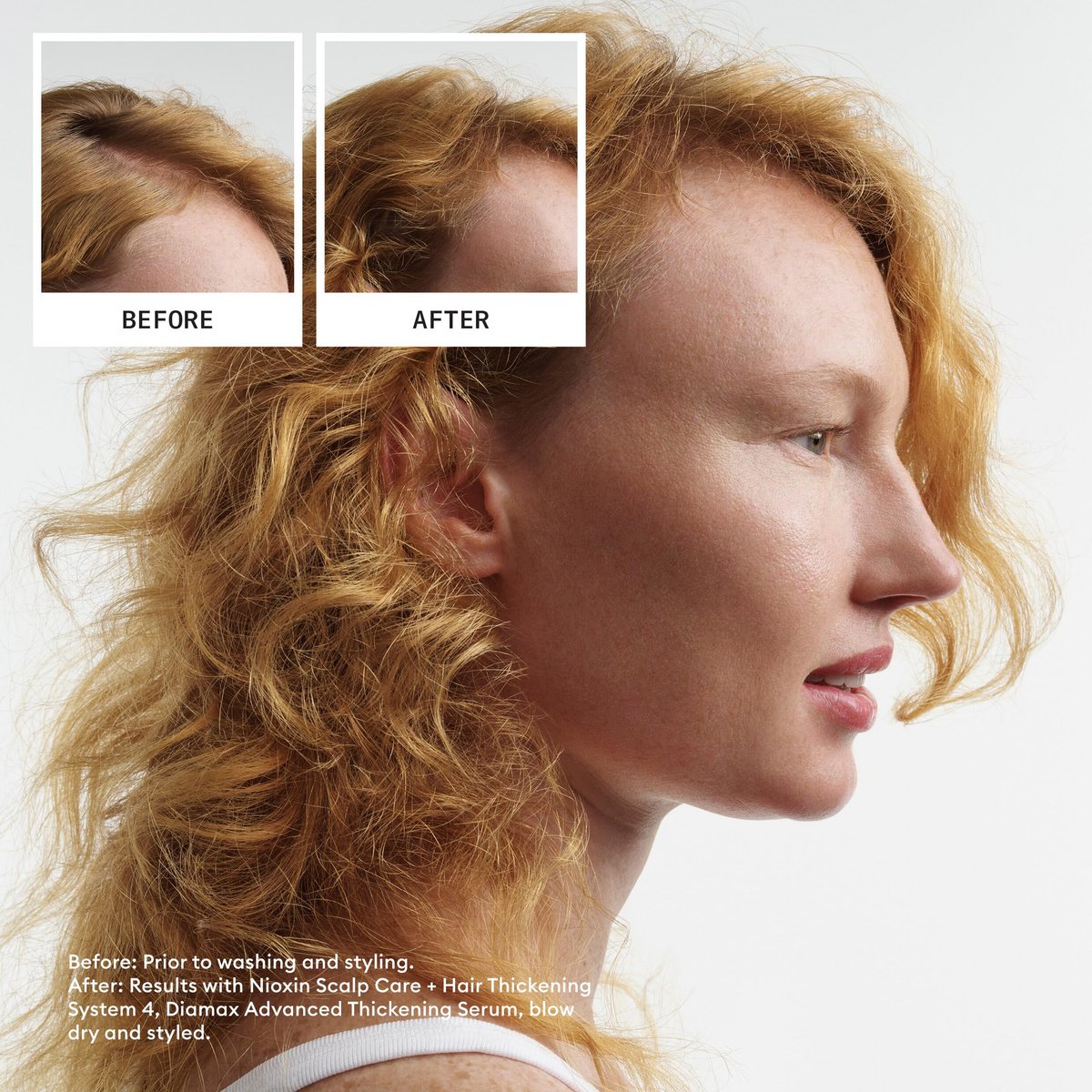 Nioxin System 4 Scalp + Hair Shampoo for Colored or Damaged Hair with Progressed Thinning - 10 Fl Oz - görsel 3