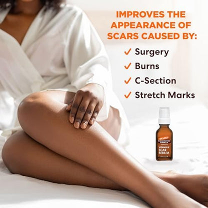 Palmer's Cocoa Butter Formula Scar Serum – Skin Brightening Oil for Face & Body, Concentrated Serum with Vitamin E, Fragrance Free, 1 Fl Oz