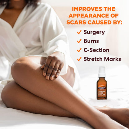 Palmer's Cocoa Butter Formula Scar Serum – Skin Brightening Oil for Face & Body, Concentrated Serum with Vitamin E, Fragrance Free, 1 Fl Oz