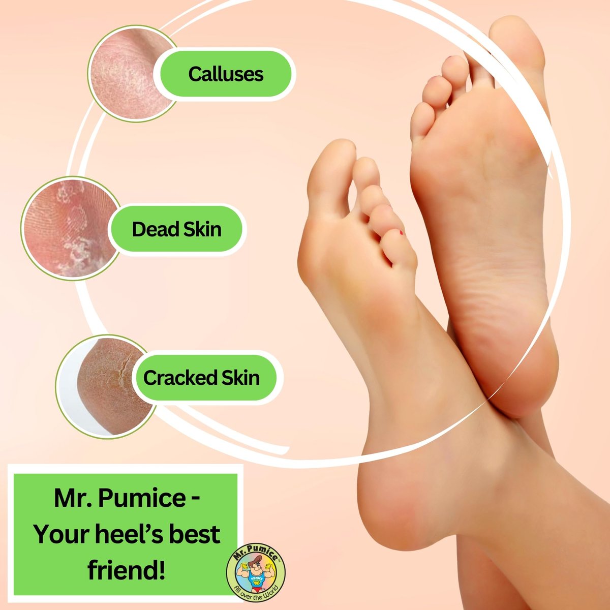 Mr. Pumice Callus Remover PUMI Bar – Medium Grit Pumice Stone for Feet & Heels, 4-Pack (Assorted Colors) - görsel 9