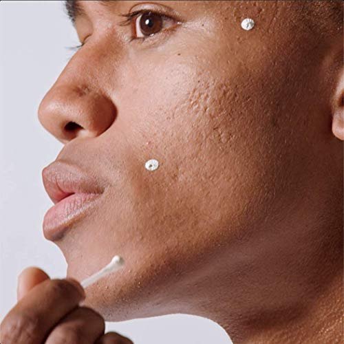 MALIN+GOETZ Acne Treatment Nighttime Overnight Spot Treatment - 10% Sulfur & Salicylic Acid, Vegan & Cruelty-Free (0.5 Fl Oz) Avelisse