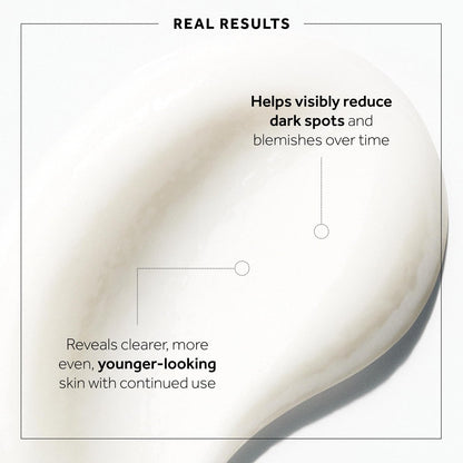 No7 Microdermabrasion Total Renewal Face Scrub – Exfoliating Face Wash & Dark Spot Corrector for Sensitive Skin Avelisse