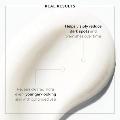 No7 Microdermabrasion Total Renewal Face Scrub – Exfoliating Face Wash & Dark Spot Corrector for Sensitive Skin Avelisse