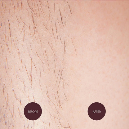 Nad's Brazilian & Bikini Wax Kit - At Home Hard Wax for Coarse Hair with Calming Oil Wipes & Wooden Spatula Avelisse