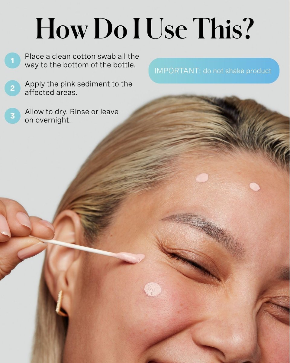 Kate Somerville EradiKate 10% Sulfur & BHA Acne Treatment – Medicated Pimple Cream & Drying Lotion for Blackheads, 1 Fl Oz Avelisse
