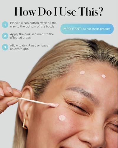 Kate Somerville EradiKate 10% Sulfur & BHA Acne Treatment – Medicated Pimple Cream & Drying Lotion for Blackheads, 1 Fl Oz Avelisse