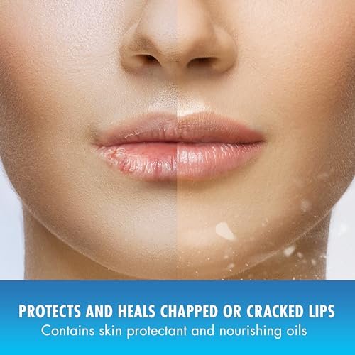 Natural Ice Original Medicated Lip Balm - Hydrating Lip Care for Dry, Chapped Lips, Moisturizing Formula with SPF 15 (Pack of 48) Avelisse