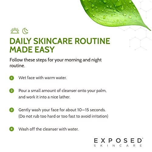 Exposed Skin Care Clearing Tonic Facial Toner – 1% Salicylic Acid & Witch Hazel for Acne, Blackheads & Oily Skin – Natural, Non-Toxic, Cruelty Free Avelisse