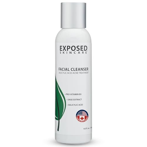 Exposed Skin Care Acne Facial Cleanser – Gentle Daily Face Wash with 0.5% Salicylic Acid for Sensitive & Acne-Prone Skin, Breakouts, Blackheads & Excess Oil – Natural, Non-Toxic & Cruelty Free (4 Fl Oz) Avelisse