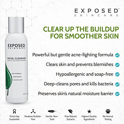 Exposed Skin Care Acne Facial Cleanser – Gentle Daily Face Wash with 0.5% Salicylic Acid for Sensitive & Acne-Prone Skin, Breakouts, Blackheads & Excess Oil – Natural, Non-Toxic & Cruelty Free (4 Fl Oz) Avelisse