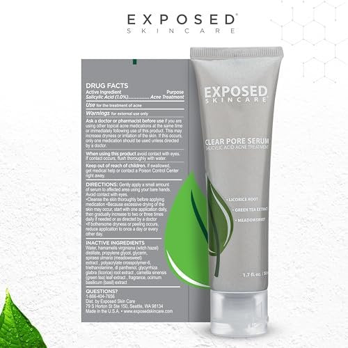Exposed Skin Care Clear Pore Serum – 1% Salicylic Acid for Sensitive & Oily Skin, Gently Clears Blackheads, Minimizes Pores, Reduces Excess Oil, Natural & Cruelty-Free (1.7 Fl Oz) Avelisse
