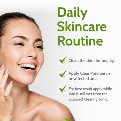 Exposed Skin Care Clear Pore Serum – 1% Salicylic Acid for Sensitive & Oily Skin, Gently Clears Blackheads, Minimizes Pores, Reduces Excess Oil, Natural & Cruelty-Free (1.7 Fl Oz) Avelisse