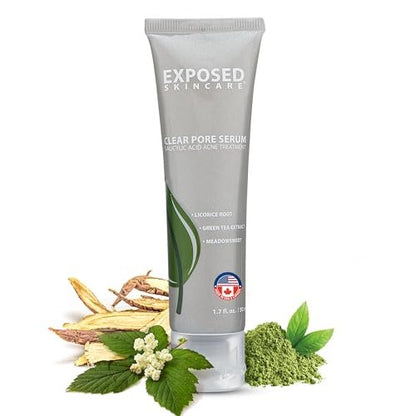 Exposed Skin Care Clear Pore Serum – 1% Salicylic Acid for Sensitive & Oily Skin, Gently Clears Blackheads, Minimizes Pores, Reduces Excess Oil, Natural & Cruelty-Free (1.7 Fl Oz) Avelisse