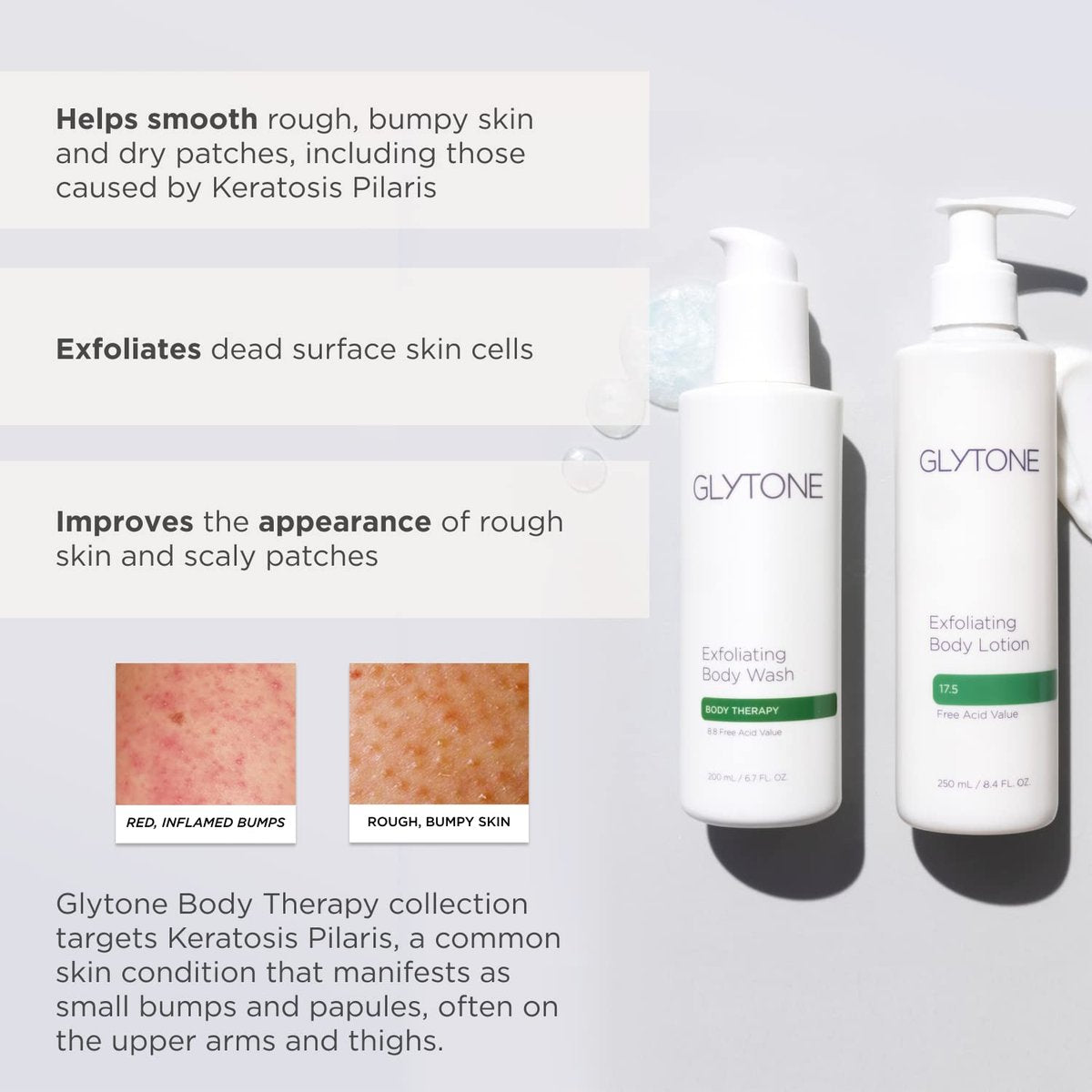 Glytone Exfoliating Body Lotion with 17.5% PFAV Glycolic Acid – Fragrance-Free Moisturizer for Dry Skin & Keratosis Pilaris, 8.4 Fl Oz Avelisse