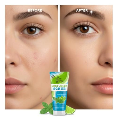 Queen Helene Mint Julep Gentle Scrub - 6 oz Exfoliating Face & Body Scrub
