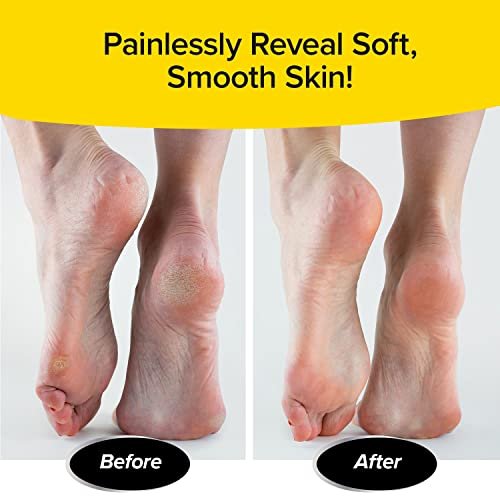 PedEgg Foot File – Mess-Free Callus Remover with Ergonomic Handle for Smooth, Soft Feet - görsel 11