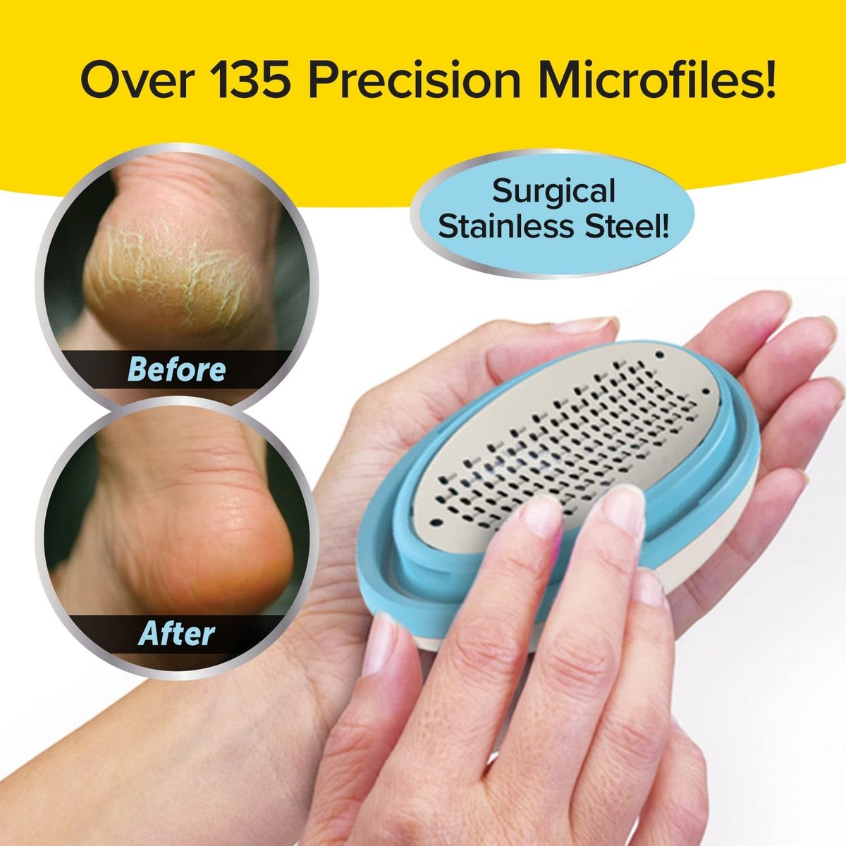 PedEgg Foot File – Mess-Free Callus Remover with Ergonomic Handle for Smooth, Soft Feet - görsel 6