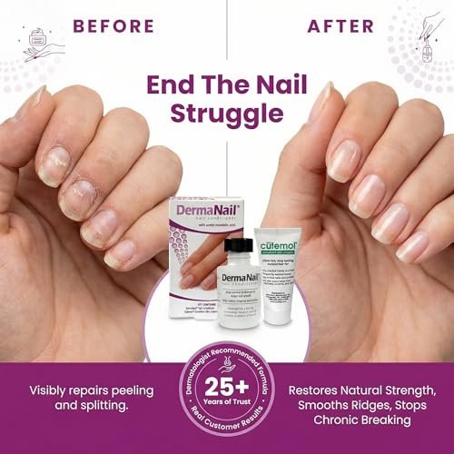DermaNail Nail Strengthener & Cuticle Cream Set - Fingernail Care Kit for Healthy Growth, Repairs Brittle, Damaged, Thin & Peeling Nails Avelisse