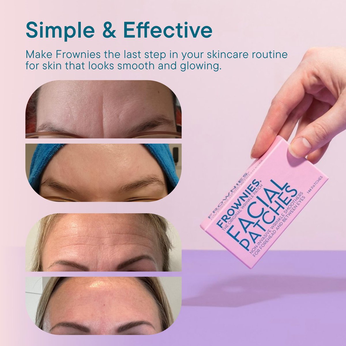Frownies Forehead & Between the Eyes Wrinkle Patches (144 Count) – Overnight Non-Comedogenic Patches to Smooth Forehead & Eleven Lines, 3 Pack Avelisse